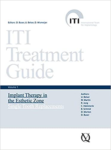 ITI Treatment Guide, Volume 1 Implant Therapy in the Esthetic Zone for Single-tooth Replacements - Epub + Converted Pdf